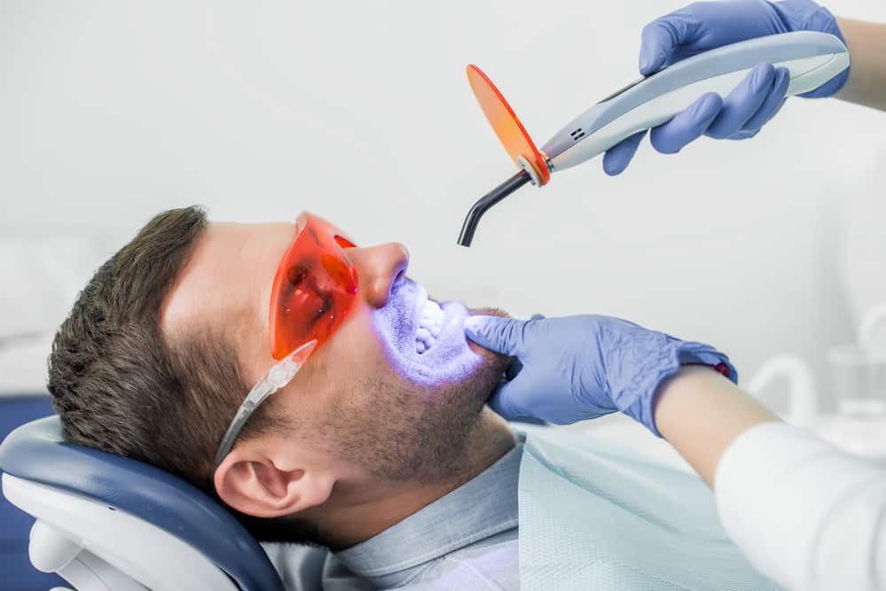 1 Hour Laser Teeth Whitening
