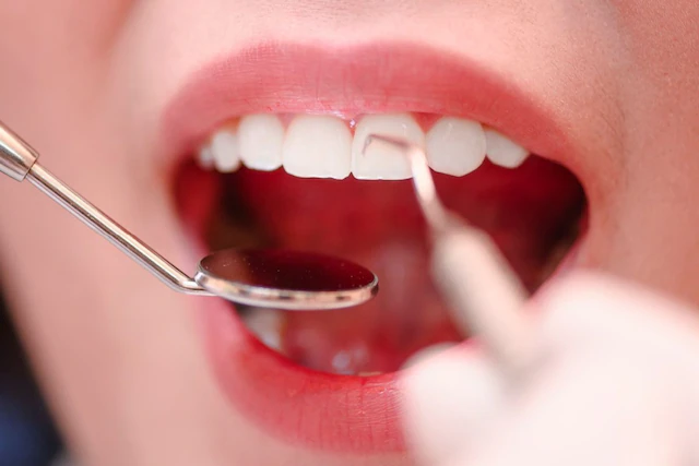 Oral Health