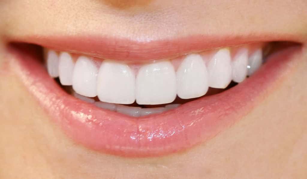 Teeth Whitening Method