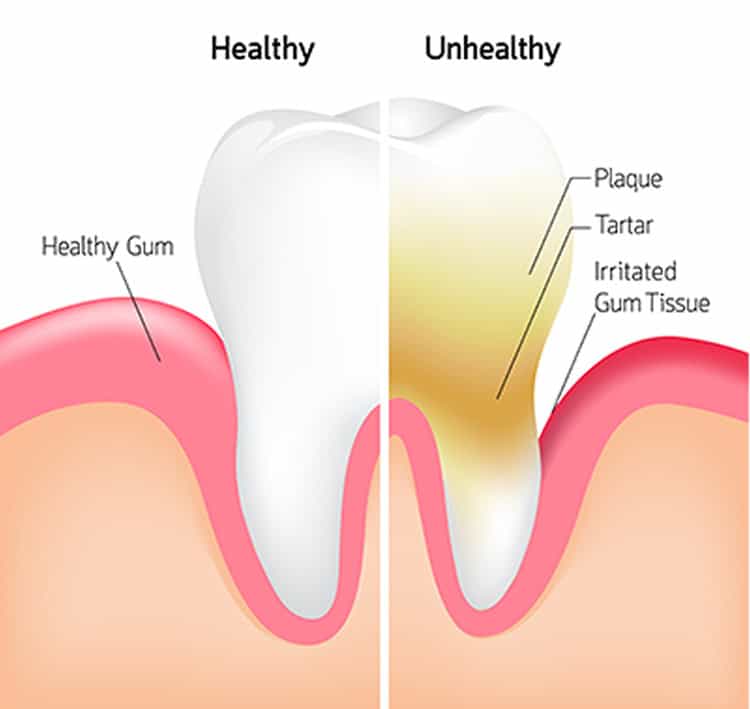 Good Dental Health