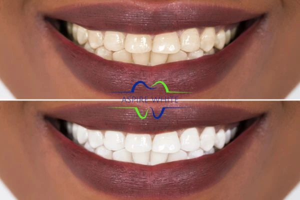 Side-by-side comparison showing before and after results of a cosmetic treatment Poole