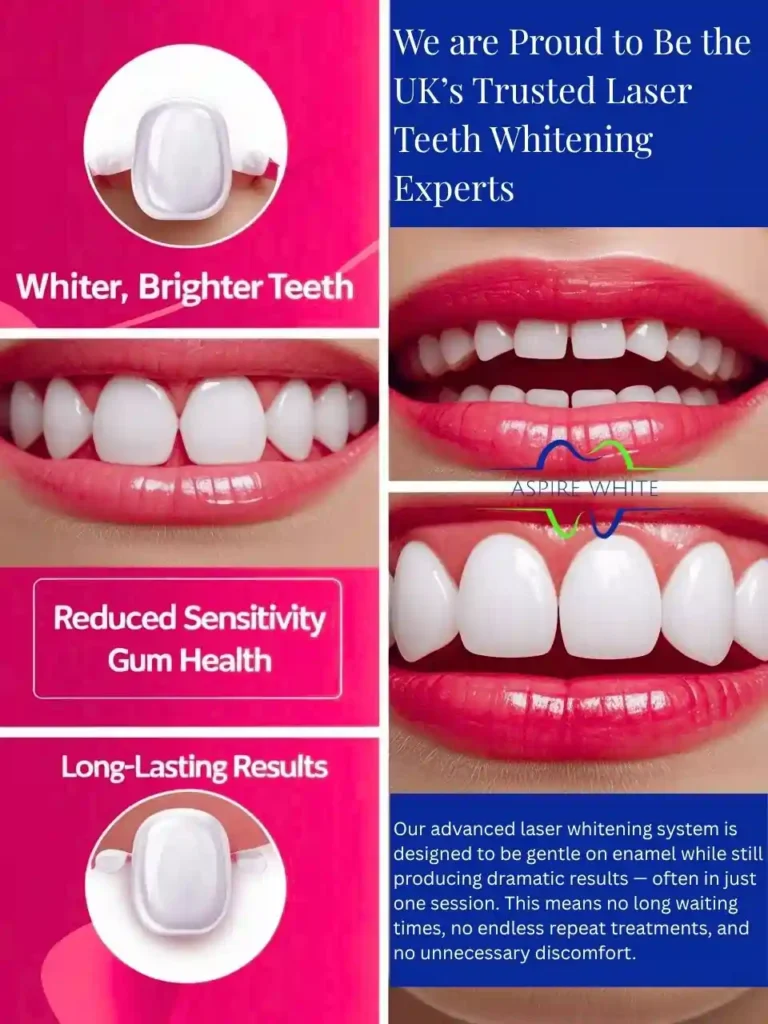 We are Proud to Be the UK’s Trusted Laser Teeth Whitening Experts Poole